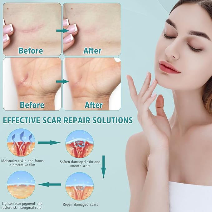 Advanced Scar Cream, Silicone Gel for Scars, Professional Scar Removal Cream for Surgical Scars, Stretch Marks, Old and New Scars 1.7 oz(50ml)-Velvo Beauty