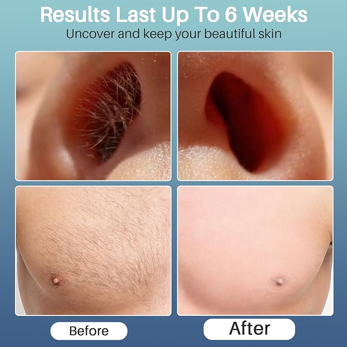 BLITZWAX Back and Nose Waxing Kit for Men, Hard Wax Warmer for Brazilian, Body and Face, At Home Hair Removal Kit, Beginner Friendly, Quick Heating, 93 Accessories, Blue Waves-Velvo Beauty