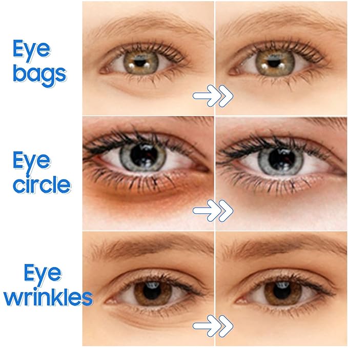 Under Eye Patches- 28 Pairs Blueberry Collagen Eye Mask Eye Patches for Reducing Puffy Eyes and Dark Circles, Anti Aging Gel Eye Pads Under Eye Mask, Blue-Velvo Beauty