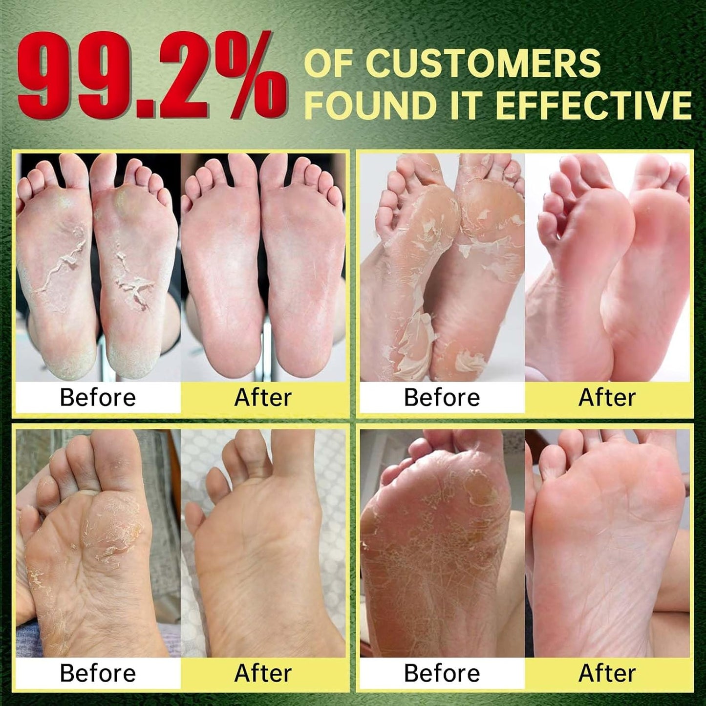 Foot Peeling Mask, Natural Exfoliating Foot Mask, Dead Skin Callus Remover Repair Heels, Hydrating Foot Care for Dry Cracked Feet（3 PacK）-Velvo Beauty