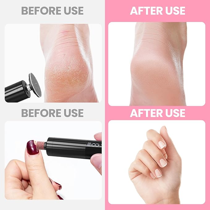 Electric Callus Remover for Feet, Rechargeable Professional Electronic Foot File Nail Grinder,9 Adjustable Speed Foot Sander Scrubber Pedicure Tool for Dry Dead Skin with Sandpaper Discs (Black)-Velvo Beauty