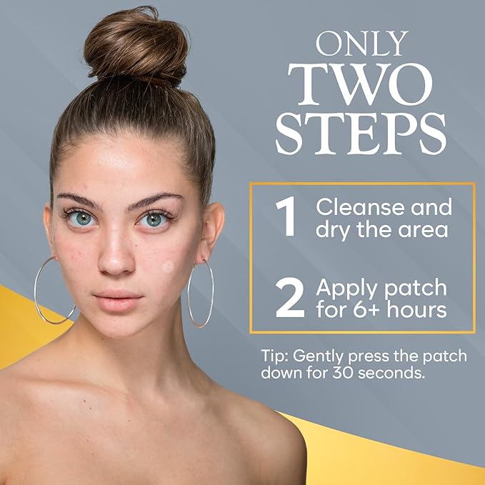 Microdart Acne Patch, Zit Patches for Cystic Acne Overnight Care, Cystic Acne Coverage, Pimple Patches Microdart Technology - Salicylic & Hyaluronic Acid (24 Count)-Velvo Beauty