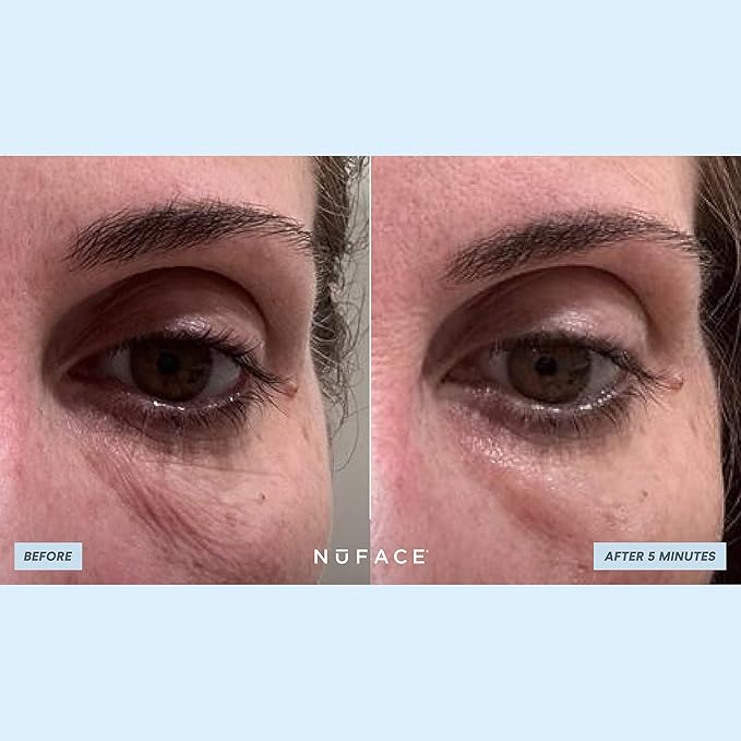 NuFACE IonPlex Hydra-Gel Power Under Eye Patches - Gel Under Eye Mask for Puffy Eyes & Dark Circles - Cooling Wrinkle Patches & Hydrating Treatment Pads to Energize, Brighten & Tighten (60 Count)-Velvo Beauty