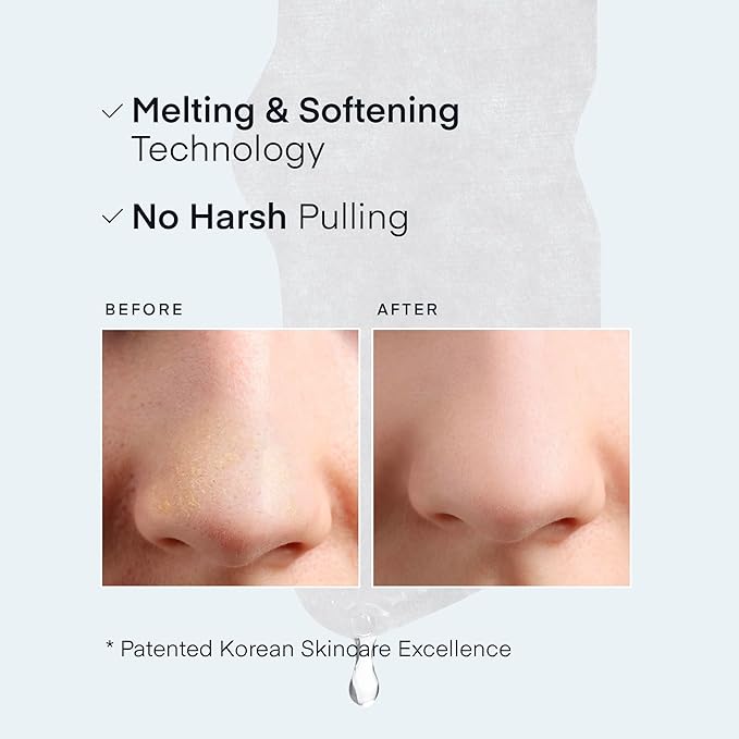 TEREZ & HONOR Korean Melting Pore Strips Blackhead Remover 5 Kits - Sebum Softener, Pore Minimizer Strips - Hypoallergenic Tested, 3-Step Pore Refining Sets-Velvo Beauty