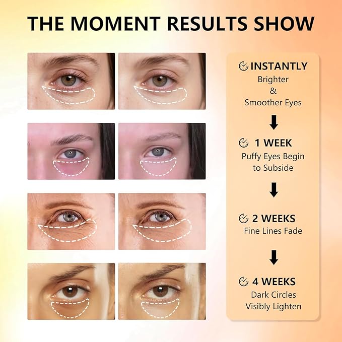 Under Eye Patches with Vitamin C & Caffeine 30 Pairs for Dark Circles, Fine Lines and Puffiness, with Niacinamide Hydra-Gel Collagen, Skin Care for Men & Women-Velvo Beauty