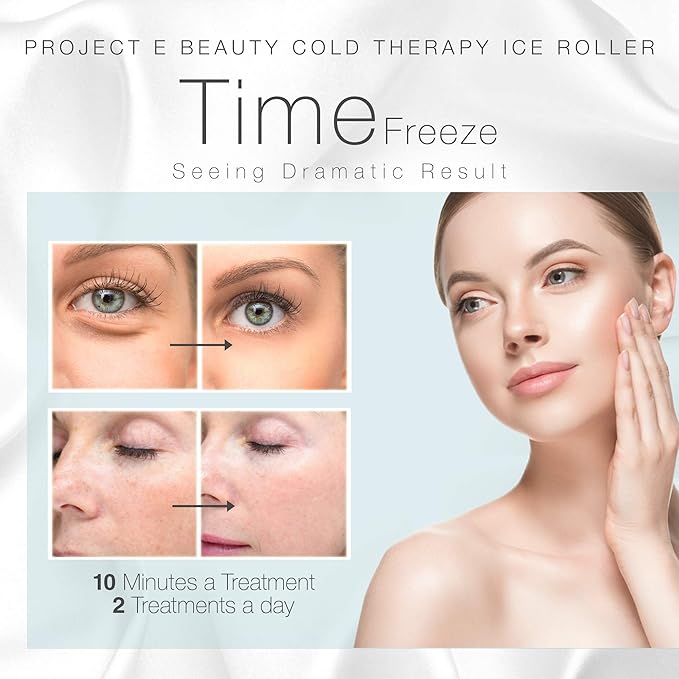 Ice Roller Cold Therapy by Project E Beauty | Reduce Under Eye Puffiness & Dark Circles | Tightens & Firms Skin | Diminish Wrinkles | Pain Relief | Muscle Soreness | Redness (Face & Body Roller)-Velvo Beauty