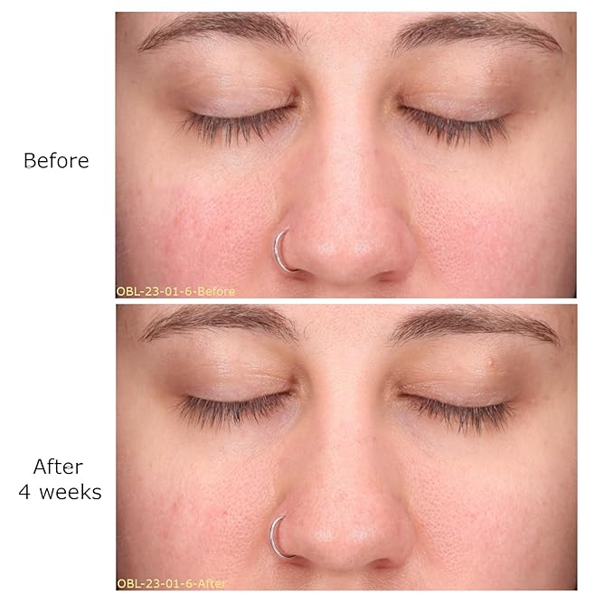 Daily Moisturizing Collection, Activator with Clarifying Azelaic Acid+ Concentrate Starter, Brightening, Firming Clarity, Suitable for Sensitive Skin, Gift Bundle/Starter Kit-Velvo Beauty