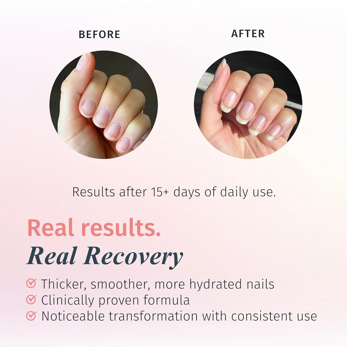 duri Rejuvacote 1 Original Maximum Strength Nail Growth System Base, Top Coat - Nails Hardening, Repair, Chipping, Strengthen, Breaking and Brittle Treatment, by Duri cosmetics (Pack of 1)-Velvo Beauty