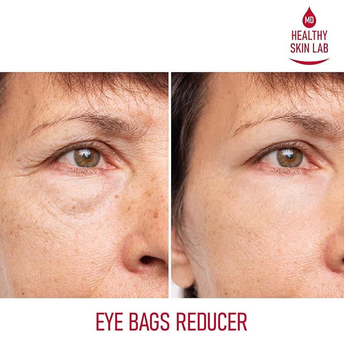 Reusable Under Eye Patches, Reduce Dark Circles, Puffy Eyes, Undereye Bags & Wrinkles - Medical-Grade Silicon Patches Reusable For Up To 3 Weeks-Velvo Beauty