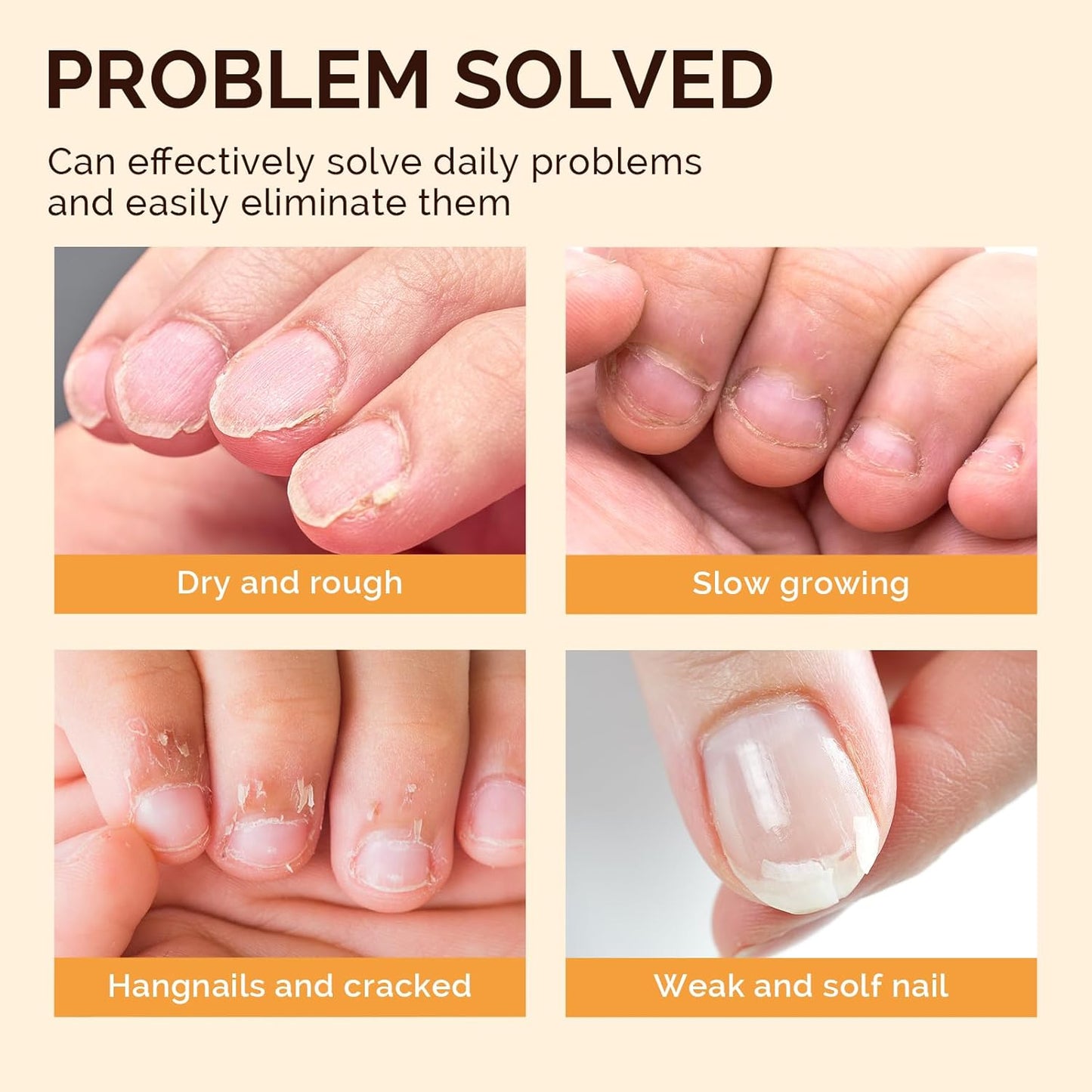 MelodySusie 12Pcs Cuticle Oil Pen Set,Nail Moisturizing Cuticle Oil Enriched with Vitamin E,Softens and Repairs cuticles,Nail Strengthener,Protects Damaged Skin,Thin Nails-Velvo Beauty