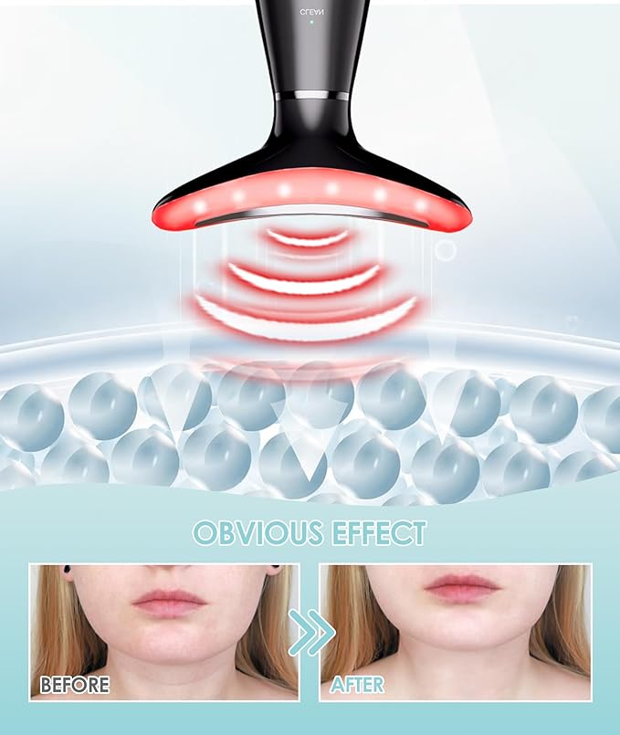 7 Color Neck Face Massager - Facial Massager Tool for Skin Care at Home, Vibrating Face Massager with Thermals, Galvanic Machines Black-Velvo Beauty