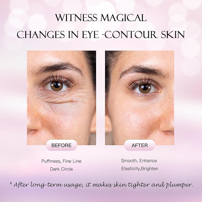 Under Eye Patches (60 Pcs) - 24K Gold Under Eye Mask - Collagen Eye Gel Pads for Removing Dark Circles, Puffiness & Wrinkles Refresh Your Skin-Velvo Beauty