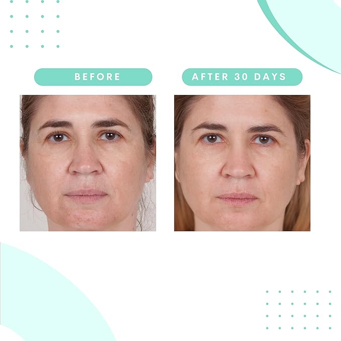 Serious Skincare Glycolic Skin Renewal Set - Retexturizing Serum - Facial Moisture Cream - Face Wash Cleanser - Balancing Blue Tansy Extract - Improve Appearance of Lines, Wrinkles and Enlarged Pores-Velvo Beauty