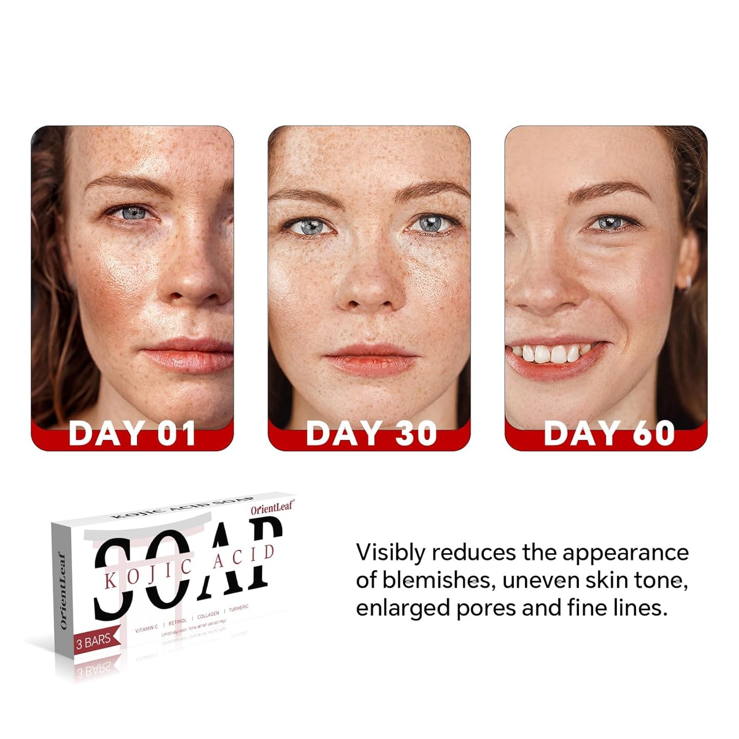 Kojic Acid Soap, Turmeric Soap Bar for Dark Spots, Fresh Citurs Scent, Gentle for Face and Body Wash with Vitamin C, Shea Butter, Retinol, Olive Oil, Collagen (3 PACK)-Velvo Beauty