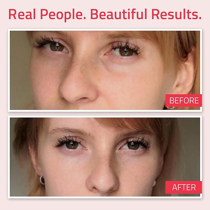 YEOUTH Retinol Eye Cream with Hyaluronic Acid, Hydrating Under Eye Cream for a Refreshed Appearance, Retinol Cream for Face, Eye Care 2oz-Velvo Beauty