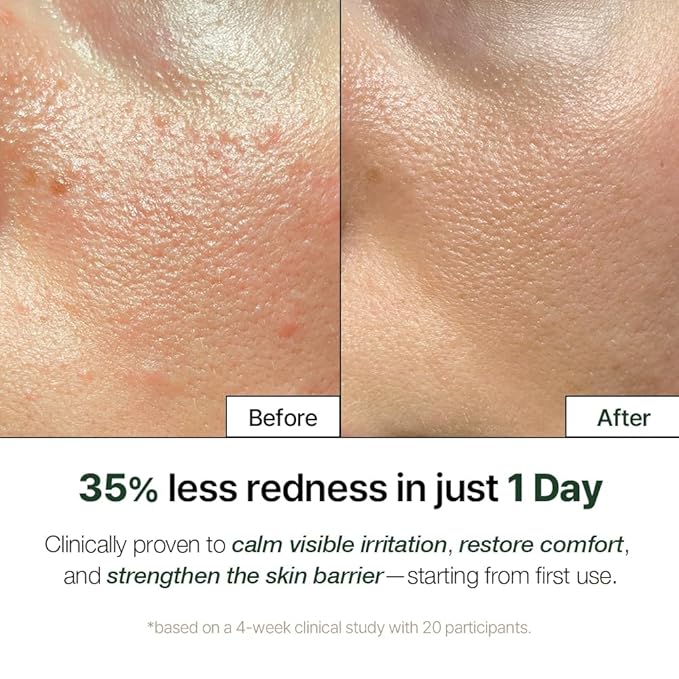 NDP Cica Cream - Gel Face Moisturizer for Sunburn Relief, lightweight Korean Moisturizer for Sensitive Skin, Centella Asiatica, Hydrating, Calming, Soothing (1.7 Fl oz / 50ml)-Velvo Beauty