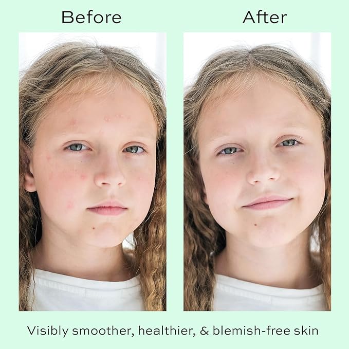 Face Moisturizer with Hyaluronic Acid Face Cream for Kids - Facial Cream & Gentle Moisturizer with Strawberry Extract & Vitamin E - Daily Facial Cream Moisturizer for Dry & Sensitive Skin 50ml-Velvo Beauty