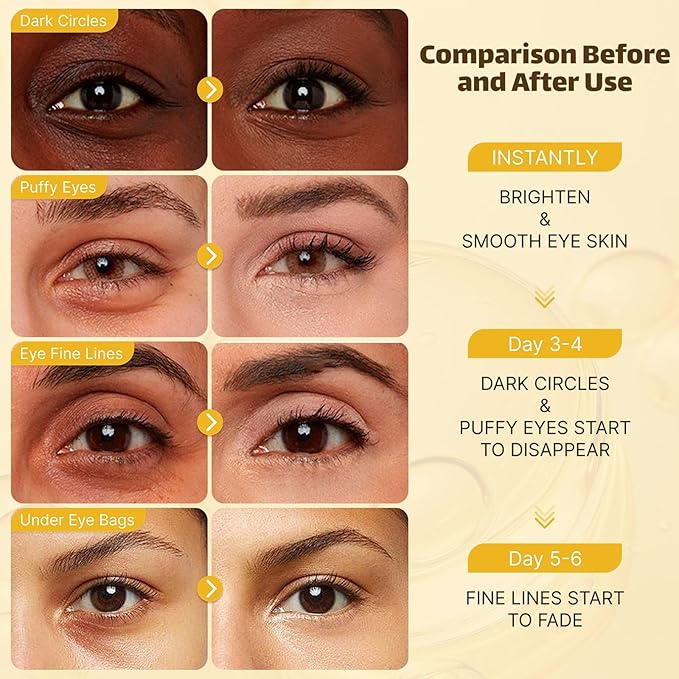 Under Eye Patches for Puffy Eyes and Dark Circles (20 Pairs), Under Eye Gold Mask with Hyaluronic Acid & Collagen to Reduce Wrinkles and Relieve Pressure, Eye Care Treatment for Men & Women Gift-Velvo Beauty