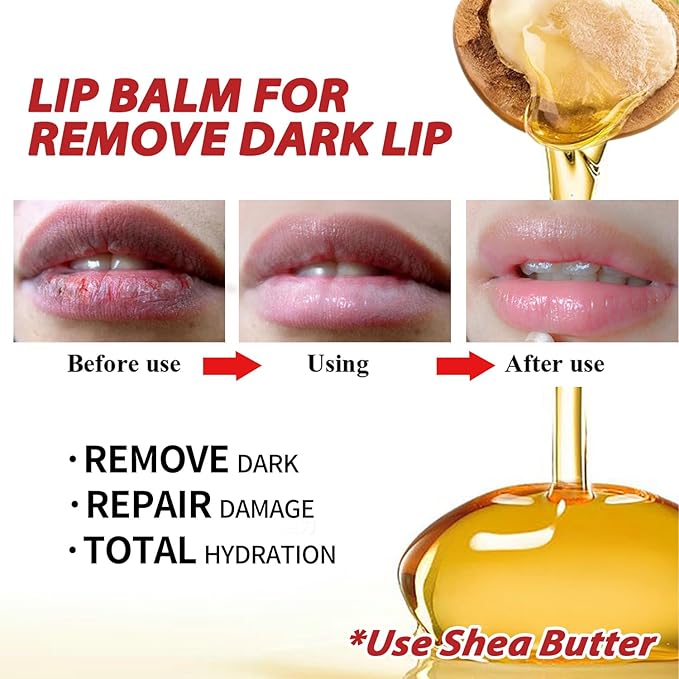 Moisture Lip Balm Lip Cream Hydrate Smooth Shea Butter Extract for Removing Dark Lip Promoting Skin Regeneration Making Lip Soft Tender & Autumn Winter Season Women Man Girl Boy Daily Lip Care-Velvo Beauty