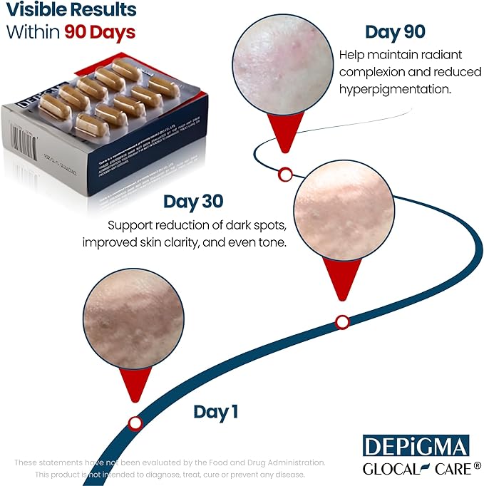 GlocalCare Depigma Support Reduction of Hyperpigmentation, Melasma & Dark Spots with Glutathione, Polypodium Leucotomos, Grape Seed & Marigold Extract-Velvo Beauty