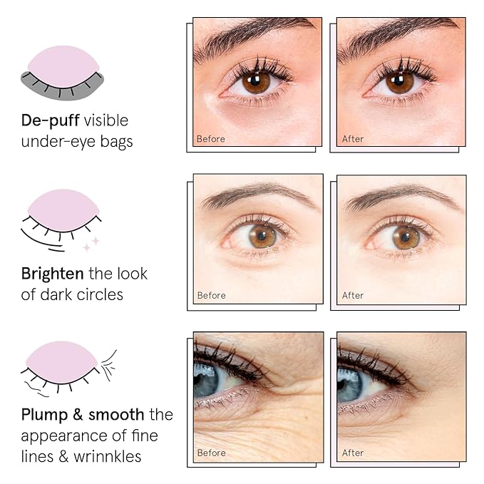 grace & stella Under Eye Patches (12 pairs) Eye Masks for Dark Circles and Puffiness - Birthday Gifts for Women, Bachelorette Party Favors, Bridesmaid Proposal Gifts, Self Care, Spa, Relaxation, Vegan-Velvo Beauty