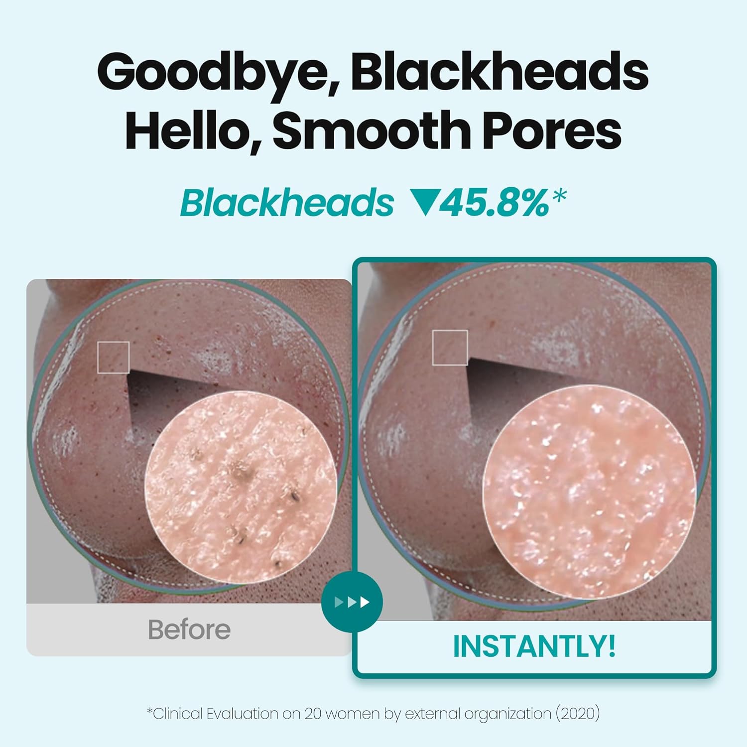 [K-Beauty] Blue Tansy Oil to Foam - All-in-One Korean Face Wash OilBased Foaming Facial Cleanser - Excess Sebum & Oil Control - Makeup Deep Cleansing Oil for All Skin Types (3.88 fl oz)-Velvo Beauty