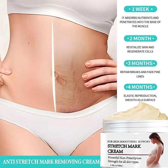 Stretch Mark Prevention Cream for Pregnancy, Stretch Mark Cream Remover, Stretch Mark Lotion for Pregnancy, Tummy Butter for Stretch Marks Pregnancy, Shea Butter Stretch Mark Removal Cream-Velvo Beauty