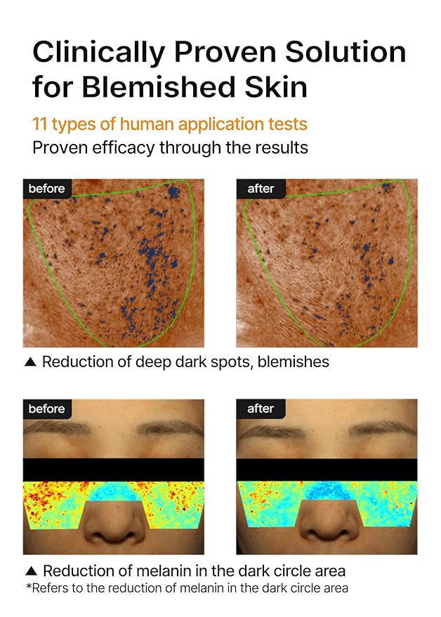 celimax Pore+Dark Spot Brightening Cream | with Niacinamide, Tranexamic Acid, TXA Cream, Pore Minimizer, Non-Irritating, Hydrating, For Sensitive Skin, 35ml-Velvo Beauty