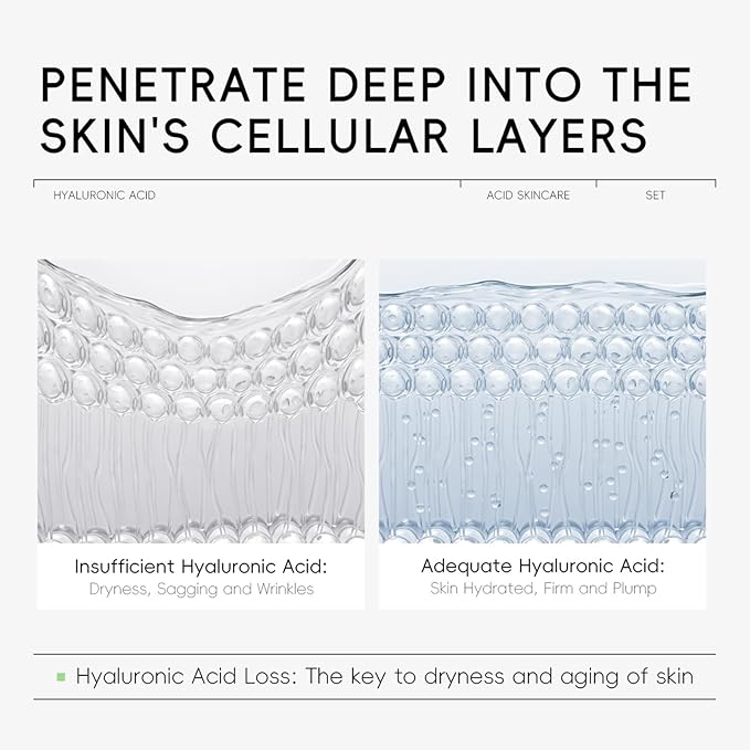 Hyaluronic Acid Skin Care Set, Hydration Kit for Women Teen Girls, Low pH Cleanser, Moisturizer, Serum, Eye Cream, Anti Aging, Firming, Travel Size Facial Care Gift Set for Dry Sensitive Skin-Velvo Beauty