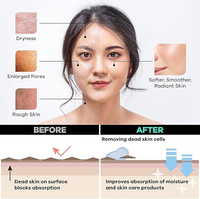 Dermasuri Deep Exfoliating Face Mitt - Scrubber, Dead and Dry Skin Remover for Men and Women - Exfoliator Gloves for Shower and Dry Use - ( 1 Pack)-Velvo Beauty