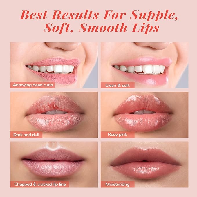 Lip Mask Set, Lip Scrub & Lip Butter, Overnight Lip Treatment Set Enriched With Skin Softening Ceramide & Watermelon and Hydrating Shea Butter, For A Softer & Smoother Pout-Velvo Beauty