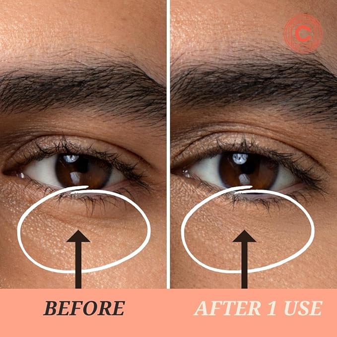 Depuffing Dissolvable Under Eye Masks - Enriched with Glucomannan, and Pumpkin Seed - Combat Fatigue, Reduce Puffiness, and Hydrate for a Fresh Look - Under Eye Mask Patches-Velvo Beauty