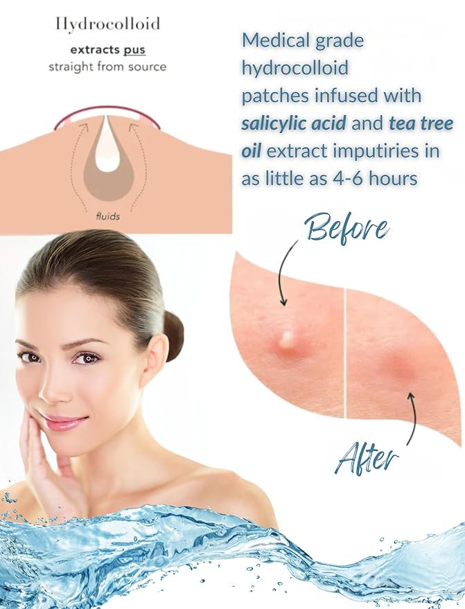 Acne Patch Ultra Thin Invisible Spot Cover- Fast Acting Hydrocolloid Pimple Patch with Salicylic Acid, Centella Asiatica & Tea Tree Oil- 72 Ct. Effective Treatment Absorbs Zits and Blemishes-Velvo Beauty