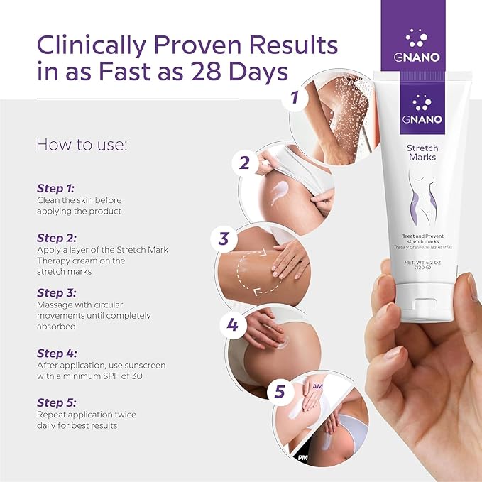 Advanced Stretch Mark Therapy Cream for Stretch Marks and firmer skin with Natural Ingredients to Prevent and get rid of Stretch Marks, Restores and Heals the Skin for Men and Women 4.2oz-Velvo Beauty