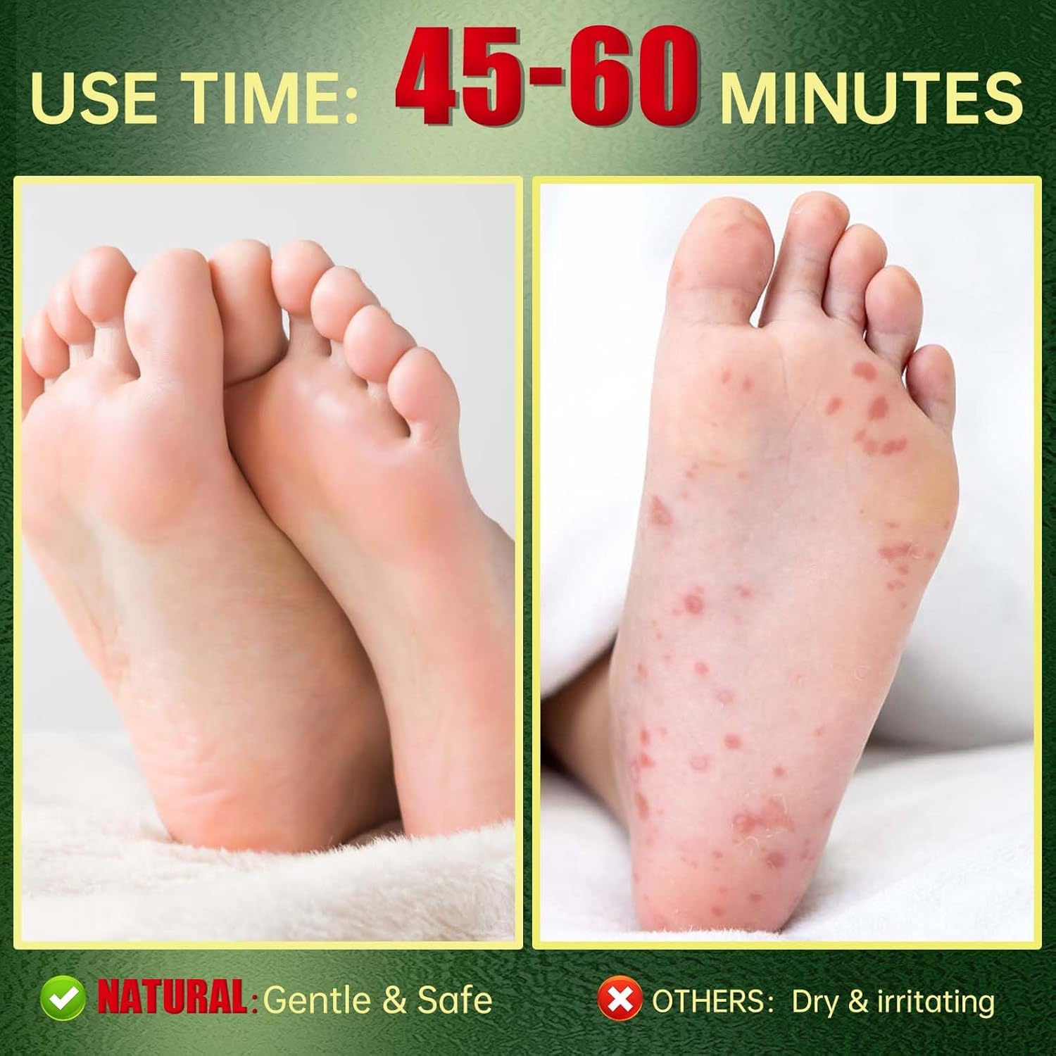 Foot Peeling Mask, Natural Exfoliating Foot Mask, Dead Skin Callus Remover Repair Heels, Hydrating Foot Care for Dry Cracked Feet (9 Pack)-Velvo Beauty