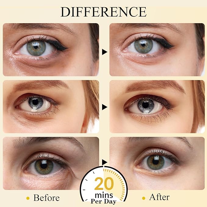 Under Eye Patches(15 Pairs), 24K Gold Eye Mask for Dark Circles, Puffy Eyes and Wrinkles, with Hyaluronic Acid & Collagen-Velvo Beauty