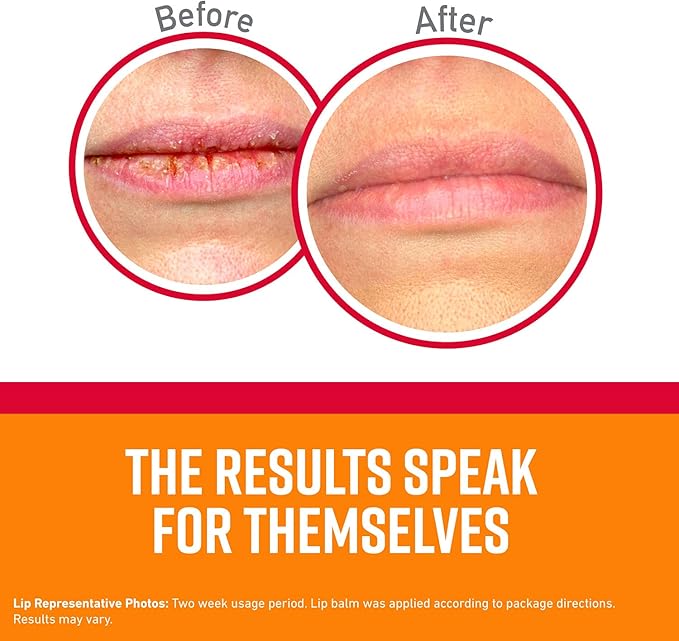 O'Keeffe's Medicated Lip Repair Seal & Heal Lip Protectant, Stick, (Pack of 2)-Velvo Beauty