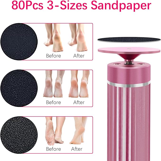 5.3'' Electric Foot Callus Remover with 80pcs Sandpaper Discs & Brush, Professional Aluminum Ergonomic Pedicure Tool, Stepless Speed & Reverse Control for Dead Skin Removal (Pink)-Velvo Beauty