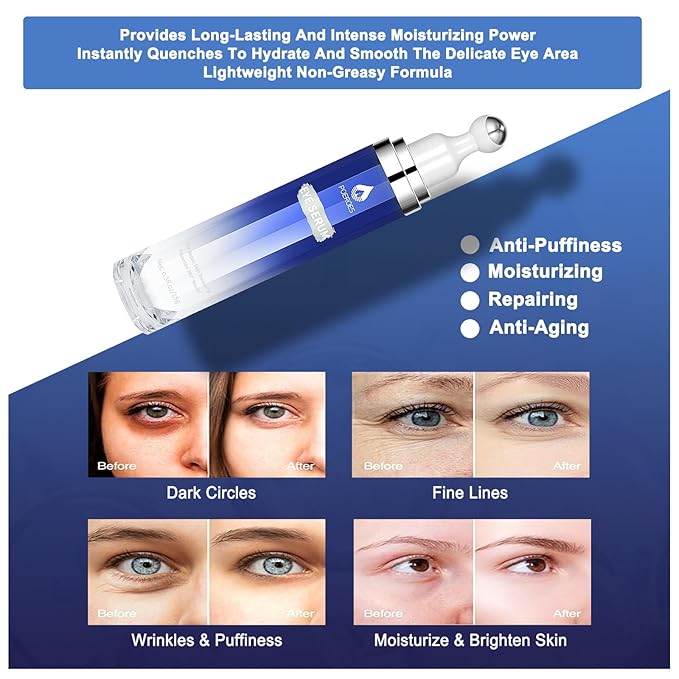 eye serum for dark circles and puffiness - 8% Caffeine, 8% Retinol - Dark Circle Remover, Puffy Eyes & Bags - Under Eye Cream, 1.5 fl. oz-Velvo Beauty