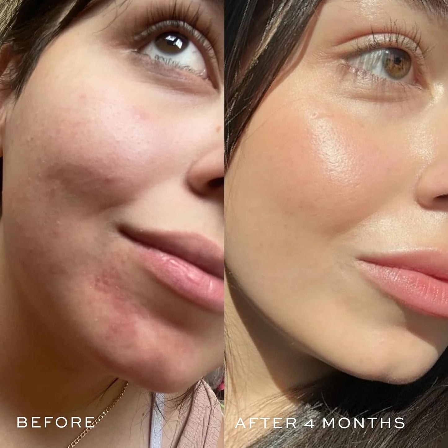 DIME Beauty Blue Facial Oil, 1 oz / 30 mL - Blemish Spot Treatment with Blue Tansy, Black Cumin Seed, Rosehip, and Grapeseed Oils-Velvo Beauty