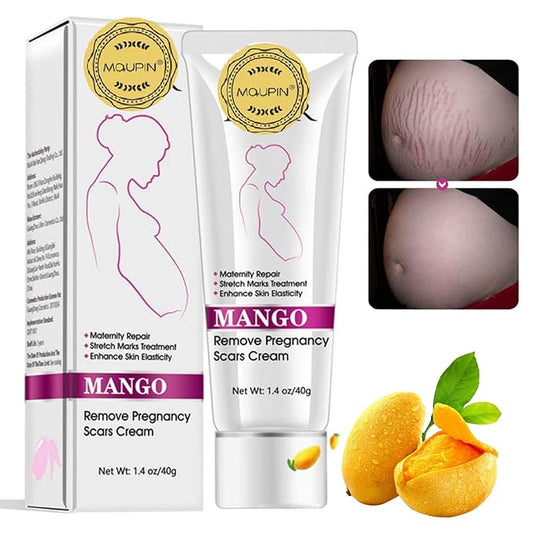 RtopR Mango Stretch Marks and Scar Cream -Stretch Marks and Scar Removal Cream for Pregnancy - Best Body Moisturizer-40g-Velvo Beauty