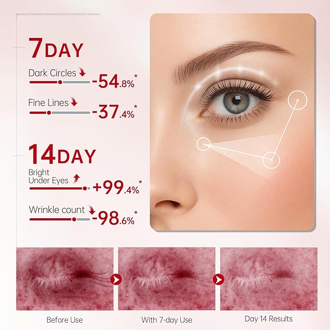 Peunitory Eye Balm Stick,Under Eye Cream Anti-Wrinkle Firming Treatment | Dark Circle Brightener | Hydrating (0.32oz)-Velvo Beauty