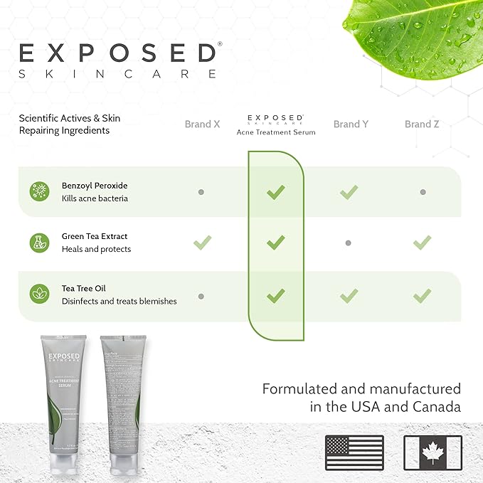 Exposed Skin Care Acne Treatment Serum Step 3 – Quickly Reduces Pimple Size and Redness - 12 Hour Spot Treatment - 3.5% Benzoyl Peroxide, Natural Green Tea & Tea Tree Oil-Velvo Beauty