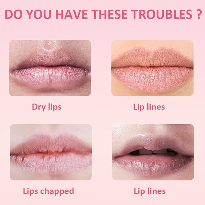 Cherry Lip Mask, Hydrating Lip Mask, Lip Treatment for Dry Cracked Lips, Avocado Coconut Sleeping Lip Mask, Lip Moisturizer Overnight, Intense Lip Repair & Care, 20G-Velvo Beauty