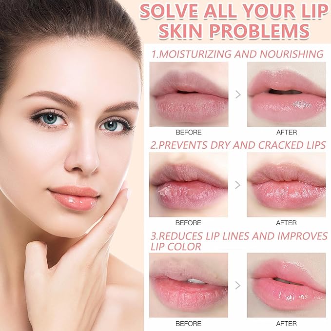 3PCS Bee Lip Balm Honey Pot,Honey Strawberry Watermelon Lip Mask Overnight Moisturizing Lip Balm,Hydrating Prevention Dry & Cracked Nourishing Sleeping Lip Mask (Honey+Strawberry+Watermelon)-Velvo Beauty