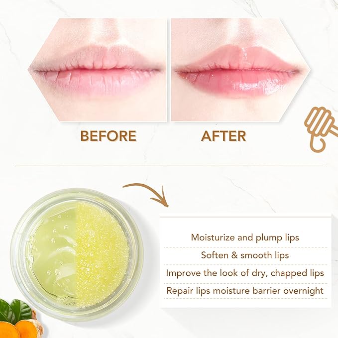 ANAIRUI Lip Therapy Set - Lip Care Kit - Includes Sugar Lip Scrub & Jelly Lip Sleep Mask, Lips Balm & Moisturizer, Dark Lip Care, Moisturizing for Fuller, Softer Lips (Turmeric & Honey)-Velvo Beauty