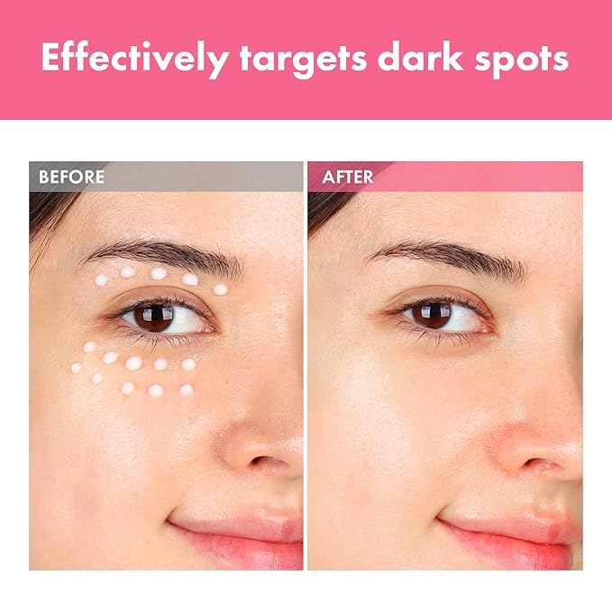 Arbutin 7% Intensive Spot Cream with 70,000ppm Arbutin, 3% Tranexamic Acid, 1% Niacinamide, Glutathione, Dark Spots, freckle, Blemishes, Anti-pigmentation, Korean Skin Care, 20ml, 0.67 fl.oz-Velvo Beauty