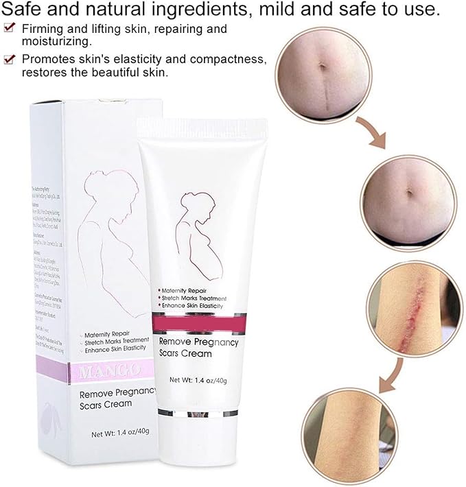 RtopR Stretch Marks and Scar Cream,Crema para Estrias De Embarazo,Stretch Marks Postpartum Repairing Cream Wrinkles Diluting Removal Cream Crema De Cacao para Cicatrices-Velvo Beauty