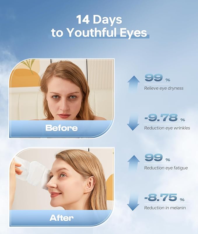 Hyaluronic Acid Self Heating Warm Compress for Eyes, Heated Eye Mask for Fast Relief of Dry Eyes, 7 Pack Steam Eye Mask, Moisturizing & Highly Effective Steam Eye Mask-Velvo Beauty