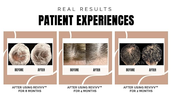REVIVV Women Hair Growth Serum, 100% Natural Growth Products, Topical Solution for Visibly Thicker & Fuller Hair, Dermatologist Recommended, 1-Pack, 1oz Bottle, 45-Day Supply-Velvo Beauty